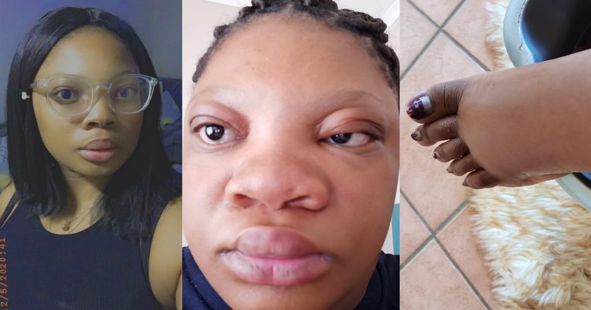 "Is she allergic to pregnancy?" – Lady's pregnancy transformation stirs unease