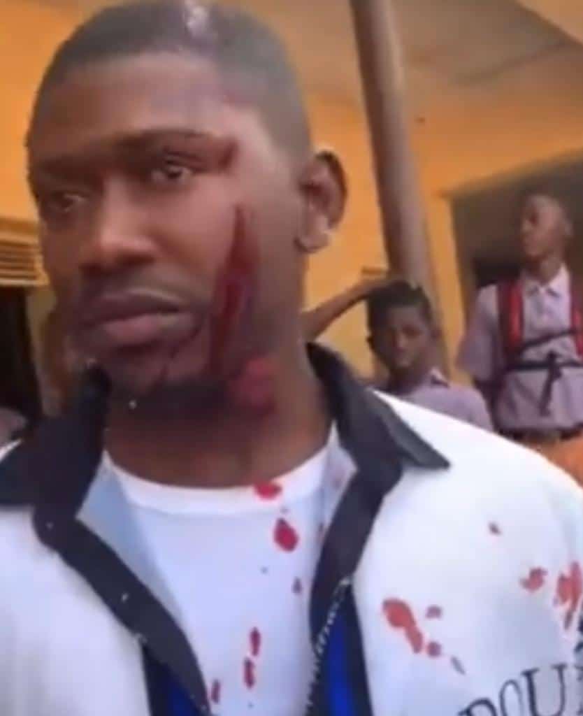Corps member escapes death after getting brutalized by his students