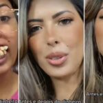 "Power of money" - Lady with crooked teeth shows off new look after surgery (Video)