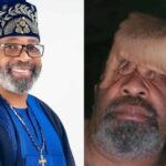 Fans express concern as Yemi Solade opens up on battling depression