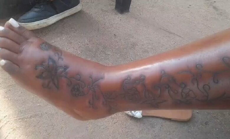 Lady in pain as she contracts infection from tattoo (Video)