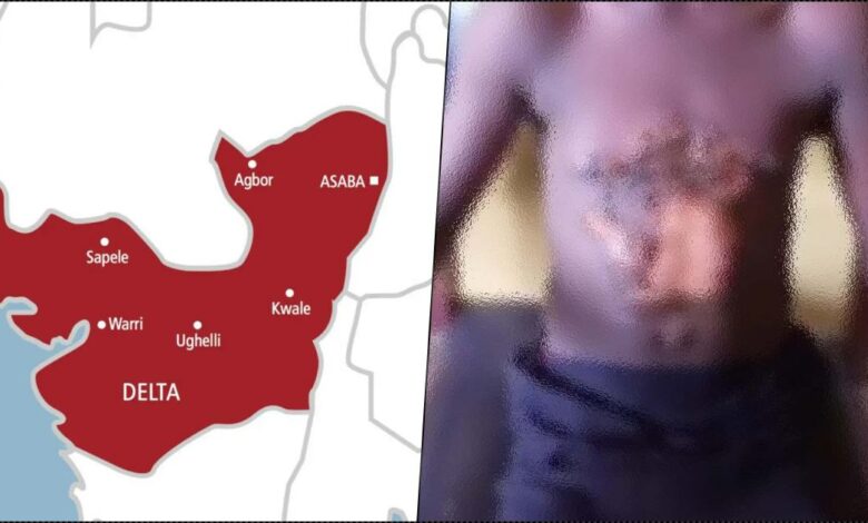Pregnant woman scalds 14-yr-old maid with hot water in Delta
