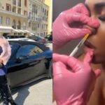 Reactions as Ada Jesus gets Botox nose job (Video)