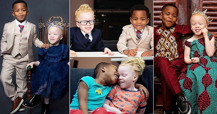 "They are twins" - Photos of albino girl and dark-skinned brother