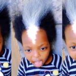 Little girl with shiny birthmark and white frontal hairs stirs reactions
