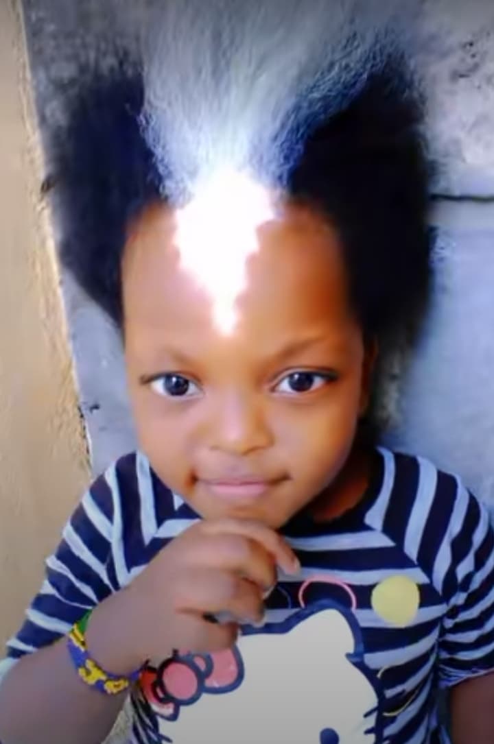 Little girl with white frontal hairs