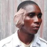 Drama as angry driver bites off VIO officer’s ear in Delta