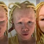 Surprising make-up transformation of albino lady goes viral
