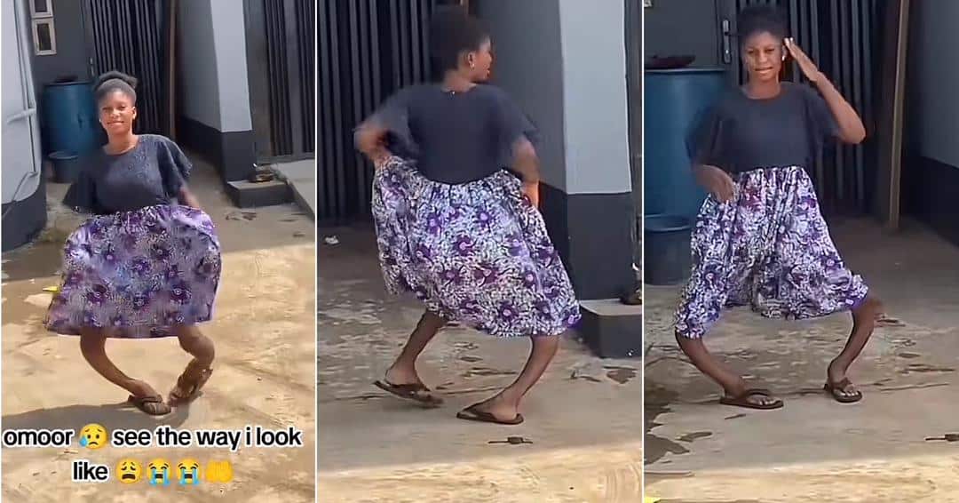 “See the way I look” – Lady cries out over rare shape of her legs