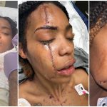 "It could've been an RIP post" - Lady stuns many as she miraculously survives after being stabbed 6 times in face and body