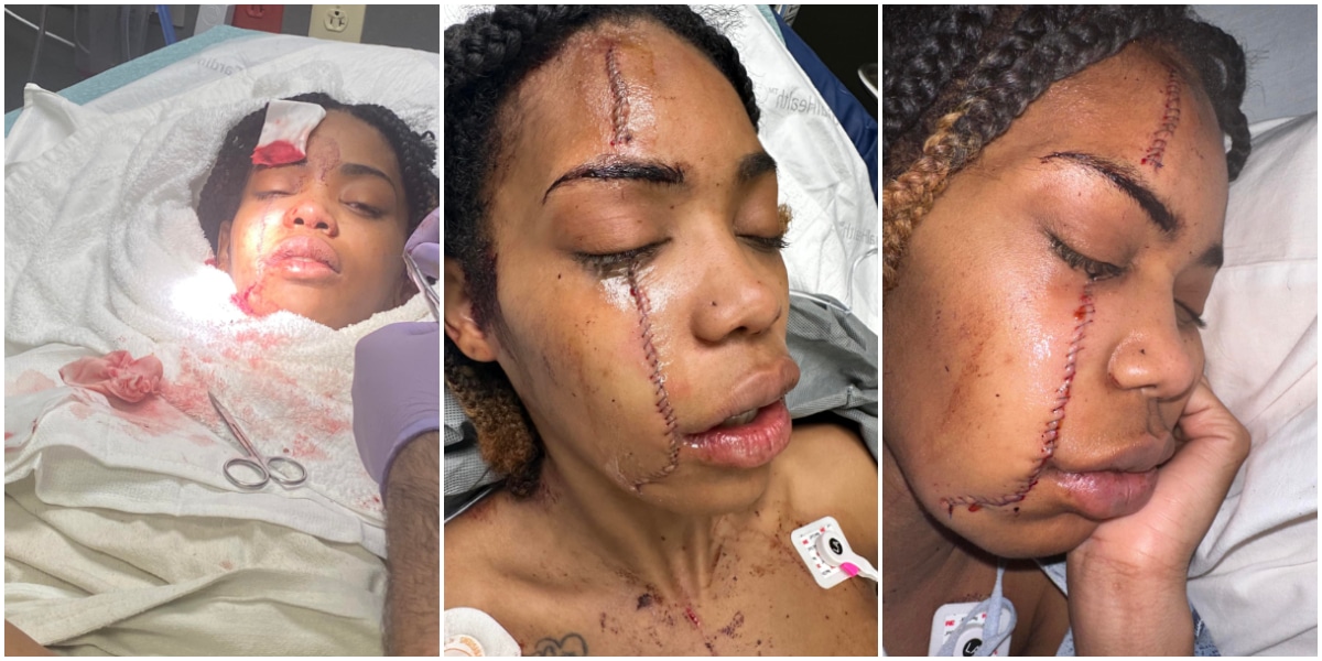 "It could've been an RIP post" - Lady stuns many as she miraculously survives after being stabbed 6 times in face and body